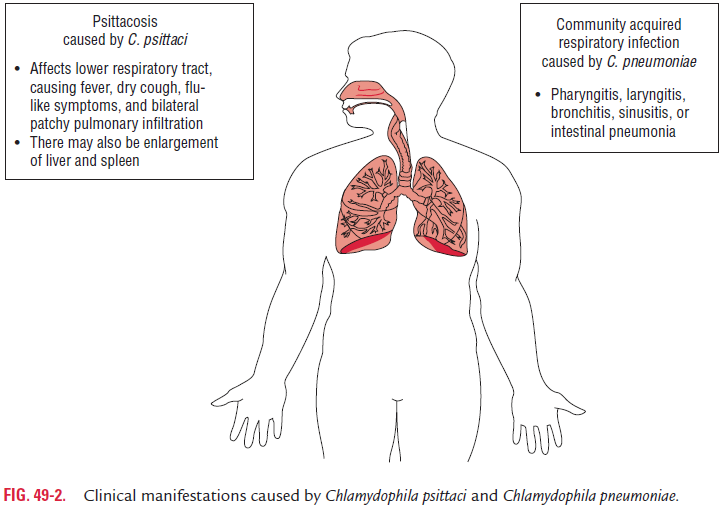 Chlamydia psittaci sẽ xâm nhập vào tế bào biểu mô đường hô hấp và nhân lên